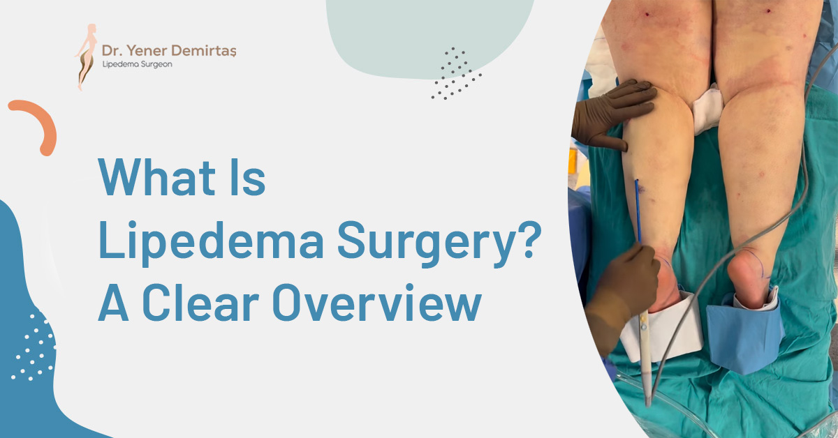 What Is Lipedema Surgery? A Clear Overview