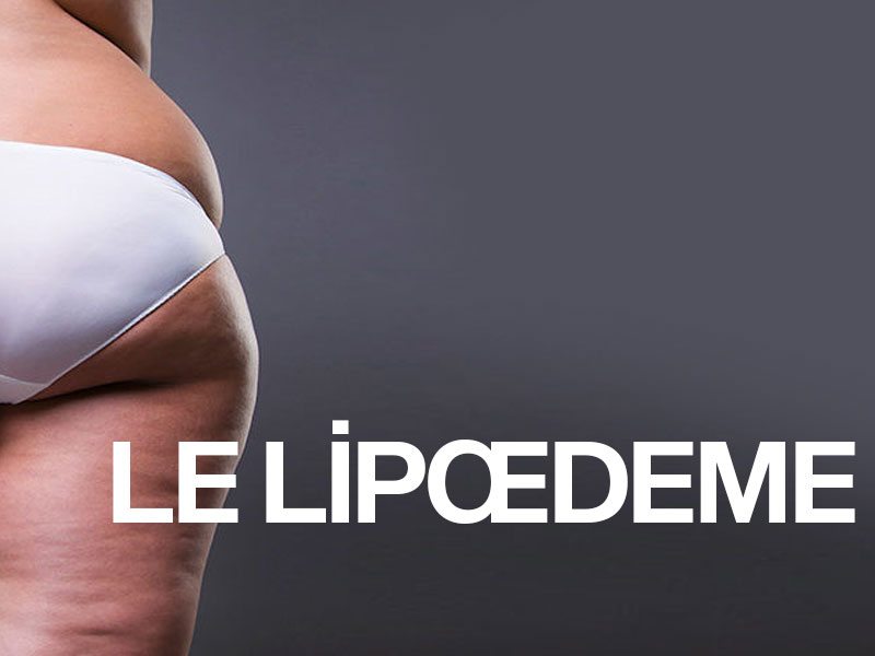 LE LİPŒDÈME